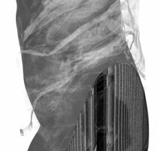 Radiology software 4 © Liz Orton