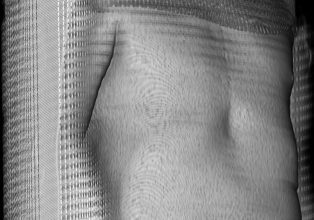 Radiology software 5 © Liz Orton