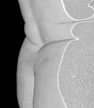 Radiology software 6 © Liz Orton