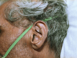 'Ear 1' from the series Illustration of Life (2003). © Max Kandhola. Courtesy the artist.